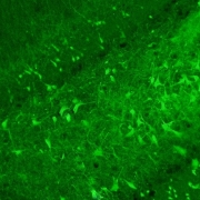 Scientists tame seizures and heal injured brains with gut chemical