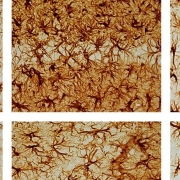 Younger brains recover better than older brains after traumatic injury, right? Maybe not